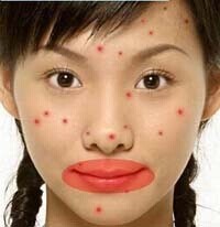 痘痘是身体什么地方出了问题,痘痘告诉你哪里生病了