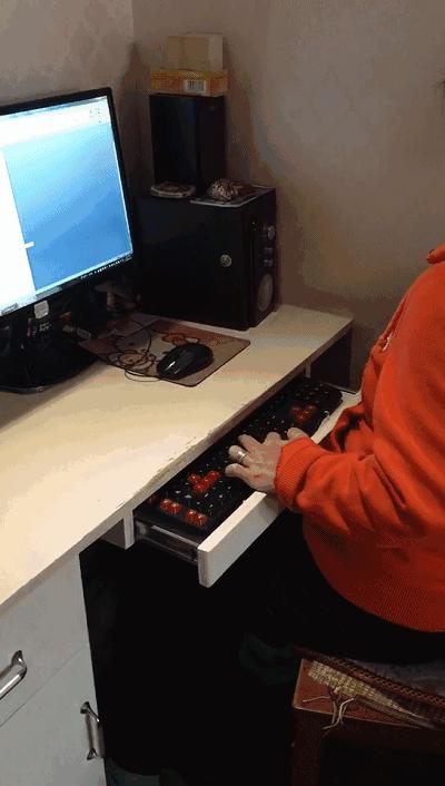 宁波市脑瘫患儿,浙江宁波哪里有脑瘫人士托养机构