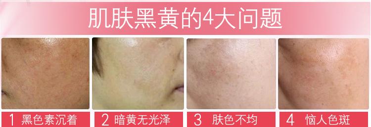 皮肤变白最快最有效的小妙招,皮肤变白小妙招小学生