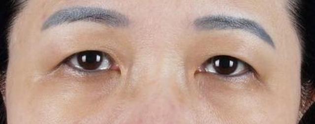 黑眼圈眼纹眼袋是怎么来的,黑眼圈眼袋眼纹问题