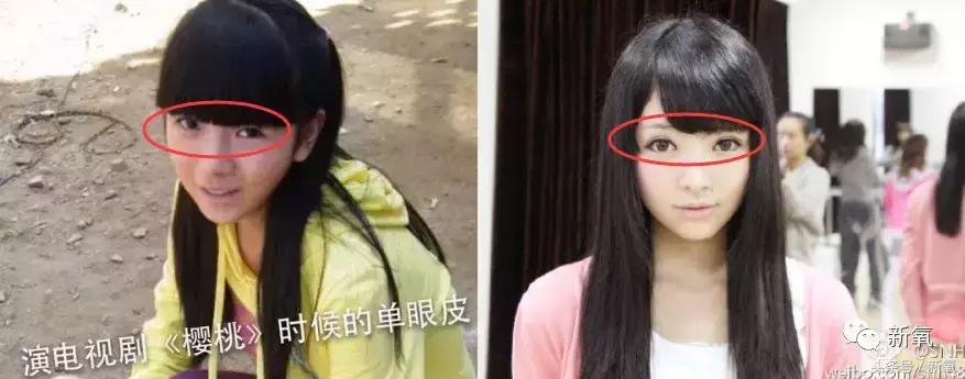 吴奇隆新剧搭档的女主13岁开始整形之路，这脸霹雳虎都hold不住！