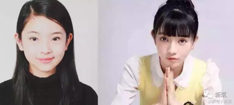 吴奇隆新剧搭档的女主13岁开始整形之路，这脸霹雳虎都hold不住！