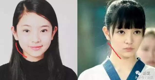 吴奇隆新剧搭档的女主13岁开始整形之路，这脸霹雳虎都hold不住！