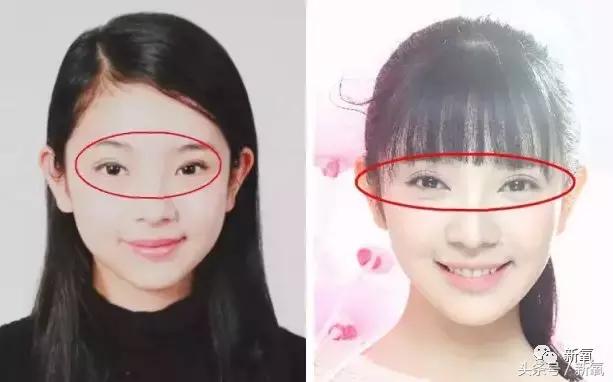 吴奇隆新剧搭档的女主13岁开始整形之路，这脸霹雳虎都hold不住！