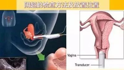 顶到宫腔了？你咋不说顶破天！