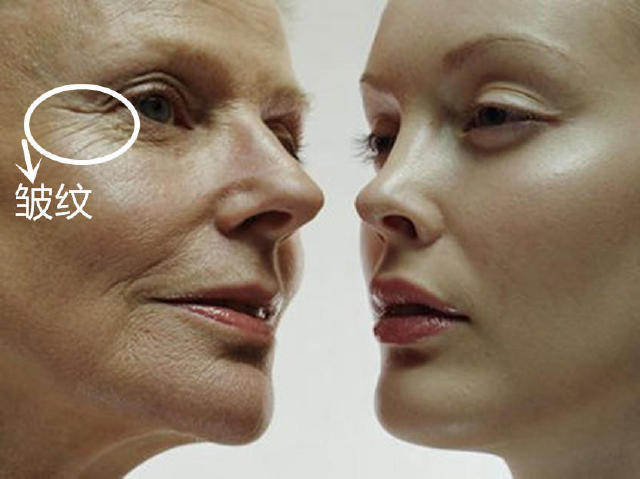 几款高性价比法令纹克星,24岁法令纹克星一览表