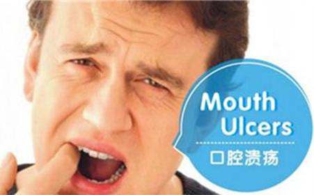 口腔溃疡雾化药物有哪些,消肿止痛的口腔溃疡药物
