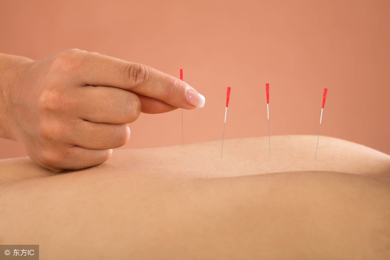 不运动不节食能减大腿吗,减肥不可盲目针灸减肥了解一下