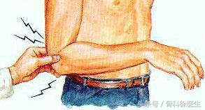 网球肘小臂疼痛难忍,如何缓解网球肘胳膊疼痛