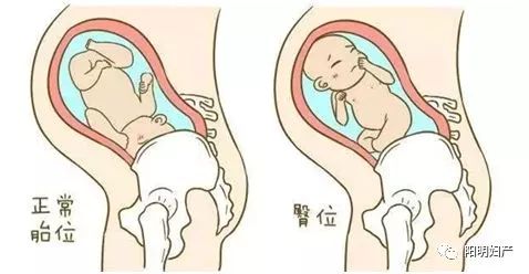 预产期期待宝宝的到来,宝宝预产期第七十天