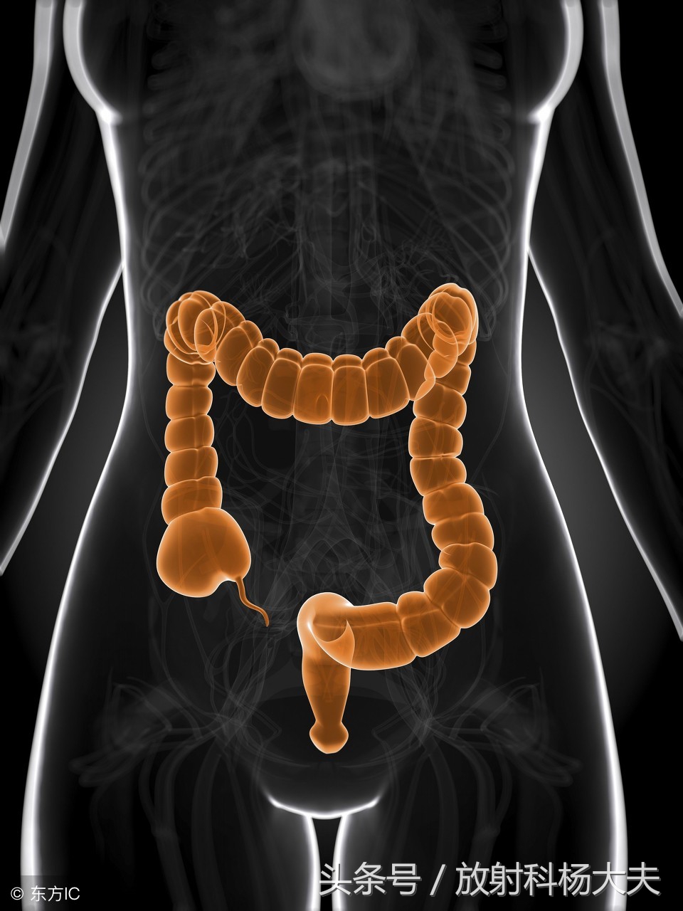 “孩子没*眼屁**”不可怕，是婴儿常见的消化道畸形，好治