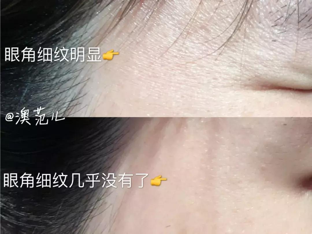 平价去皱抗衰老精华,澳洲抗皱精华