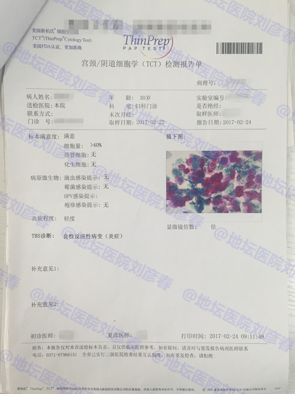 病例分享——如何提高HPV的清除率？