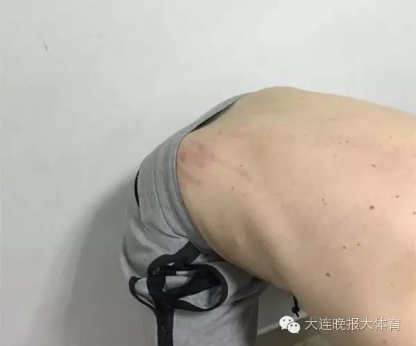 足协杯苏宁遭业余球队罕见*攻围**，武汉宏兴表示打人者一律开除！