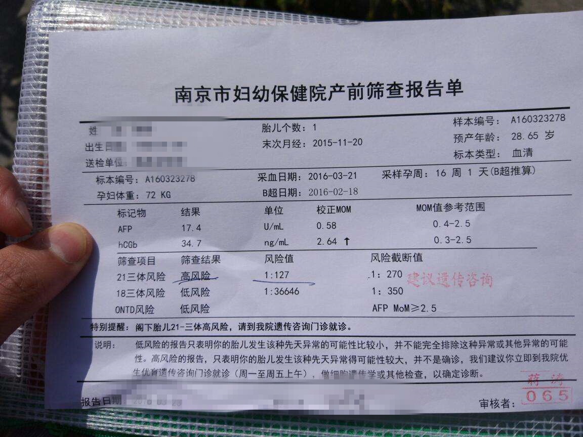 唐筛是什么一般怀孕几个月做唐筛,唐筛多久出结果唐筛是检查什么的