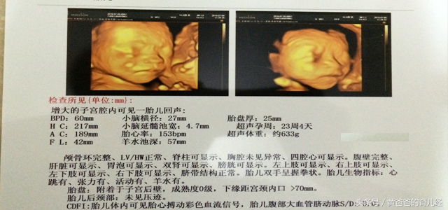 孕期想检查羊水是否正常,孕期看化验单