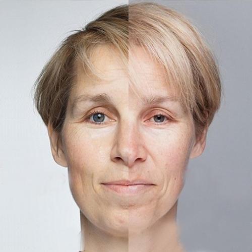 逆龄秘诀淡化法令纹,逆龄消法令纹