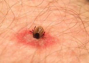 采野菜踏青，“虫子”钻进了她的太阳穴！