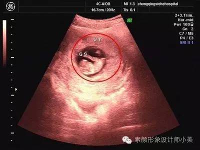 孕育课堂：怀孕八周胎儿发育与孕妈变化