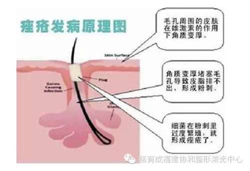 皮肤疮的种类症状及治疗,面部疮疡
