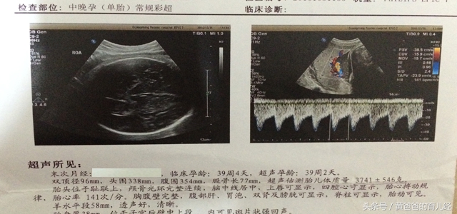 孕期想检查羊水是否正常,孕期看化验单