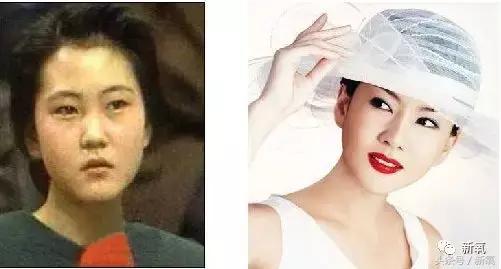 曾陷入小三、被*养包**传闻的女神公开承认整形，依然吊打少女幂和糖