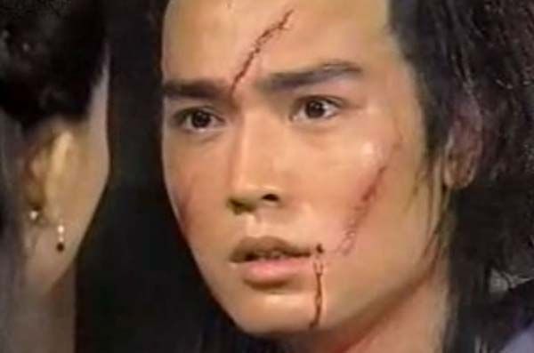 脸部疤痕对人的影响,脸上疤痕位置对面相有什么影响