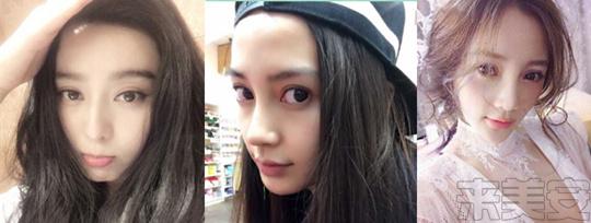 割双眼皮后悔的多还是不后悔的多,割双眼皮为什么前30天就那么难看