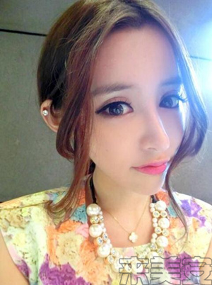 割双眼皮后悔的多还是不后悔的多,割双眼皮为什么前30天就那么难看