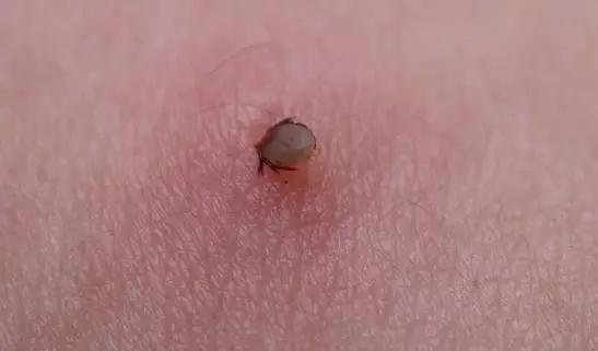 夺命蜱虫一般出现在哪里,夺命蜱虫一般出现在哪个地方