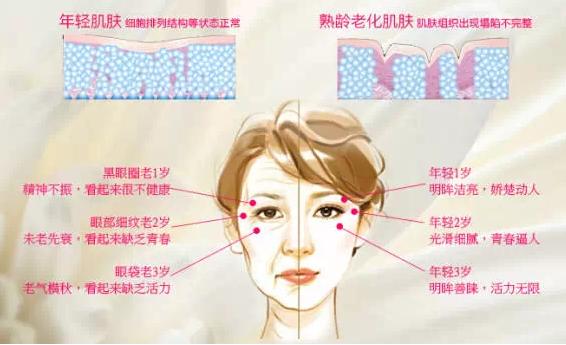 如何去除眼袋皱纹？养成好眼部的护理习惯