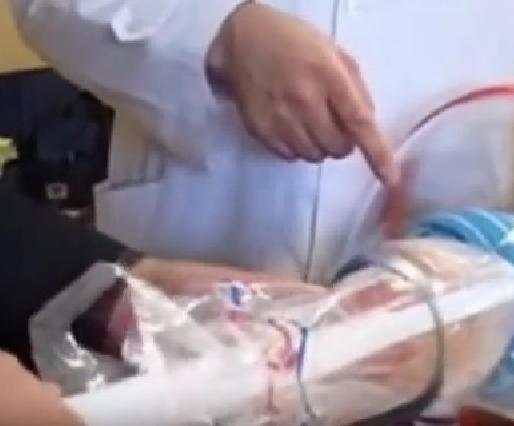 谁会想到，分娩辅助器点子，来自空瓶取软木塞