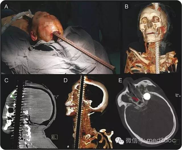 都伤成这样了还奇迹生还！向医生致敬！