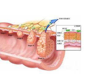 肛肠科检查为什么总要用手指摸肛门？肛瘘手术后还会复发吗？
