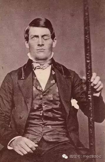 都伤成这样了还奇迹生还！向医生致敬！