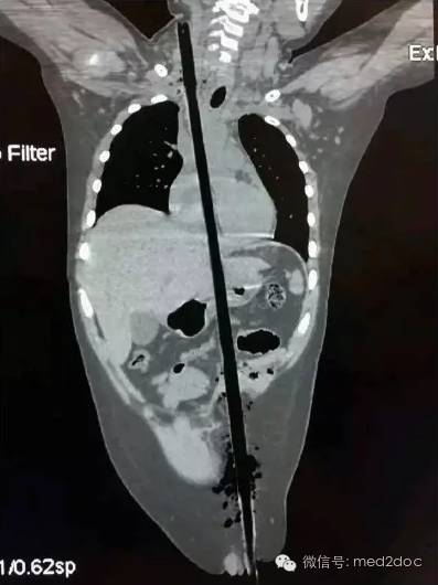 都伤成这样了还奇迹生还！向医生致敬！
