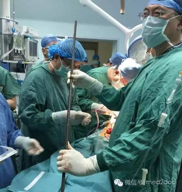 都伤成这样了还奇迹生还！向医生致敬！