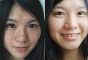 怎么才能跟脸上的斑说拜拜,如何跟黑眼圈和解