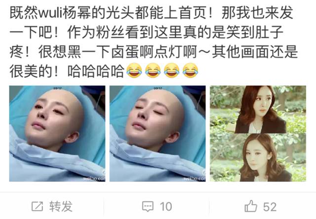 就算爱豆变光头，依旧是迷妹们最喜欢的一颗卤蛋。