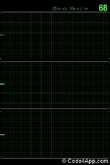 这项最便宜的检查，你做了吗？