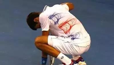 躺下突然天旋地转怎么治疗好,起立时头晕天旋地转什么情况