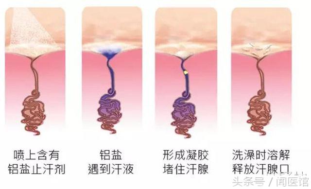 腋下有狐臭怎么办才能根除,有狐臭在尴尬的时候怎么办