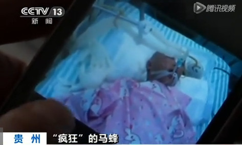 马蜂蛰了用清凉油能解毒吗,清凉油能不能治被马蜂蛰