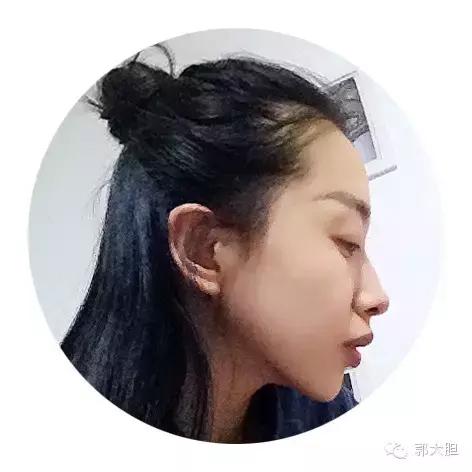 缺一颗门牙能戴隐形牙套吗,门牙龅牙医生建议磨小戴牙套