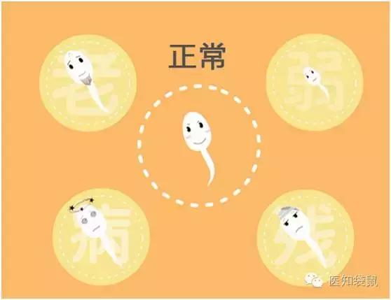 备孕有必要做孕前检查吗,四十岁备孕孕前检查哪些项目