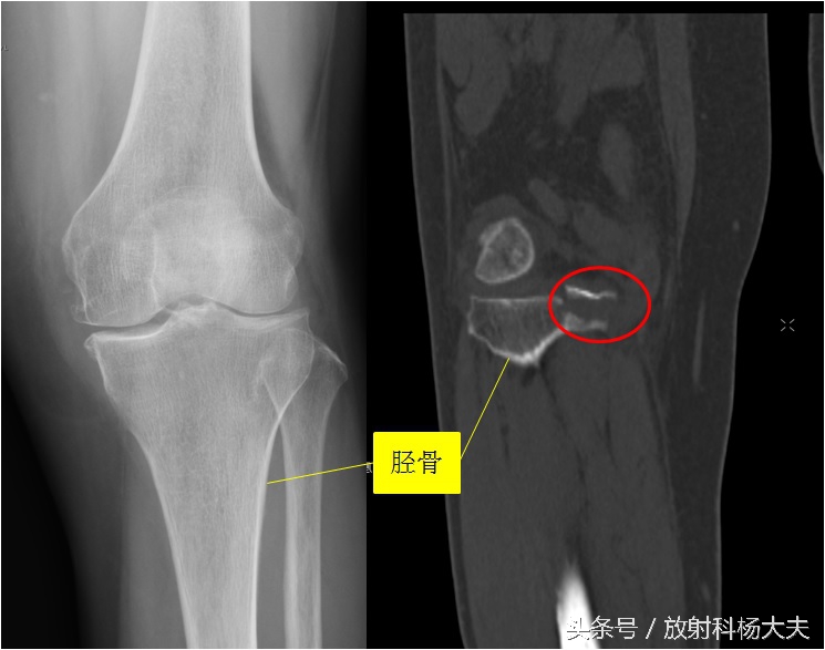 足球登巴巴受伤,足球登巴巴事件