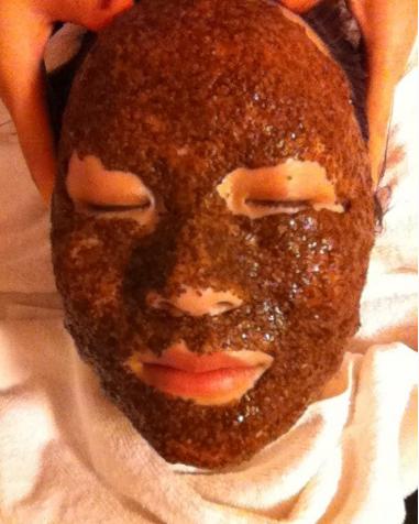 祛黑色痘印最省钱的办法,祛黑头痘痘痘印最省钱的途径