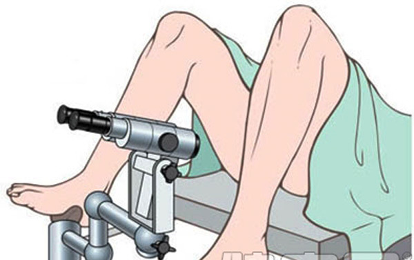 女性要注意，不要忽视宫颈息肉，病变可能会引发宫颈癌