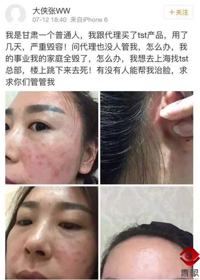 张庭的护肤品毁脸，张馨予、郭德纲自创的就靠谱吗？