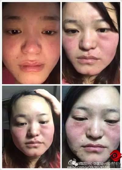 张庭的护肤品毁脸，张馨予、郭德纲自创的就靠谱吗？